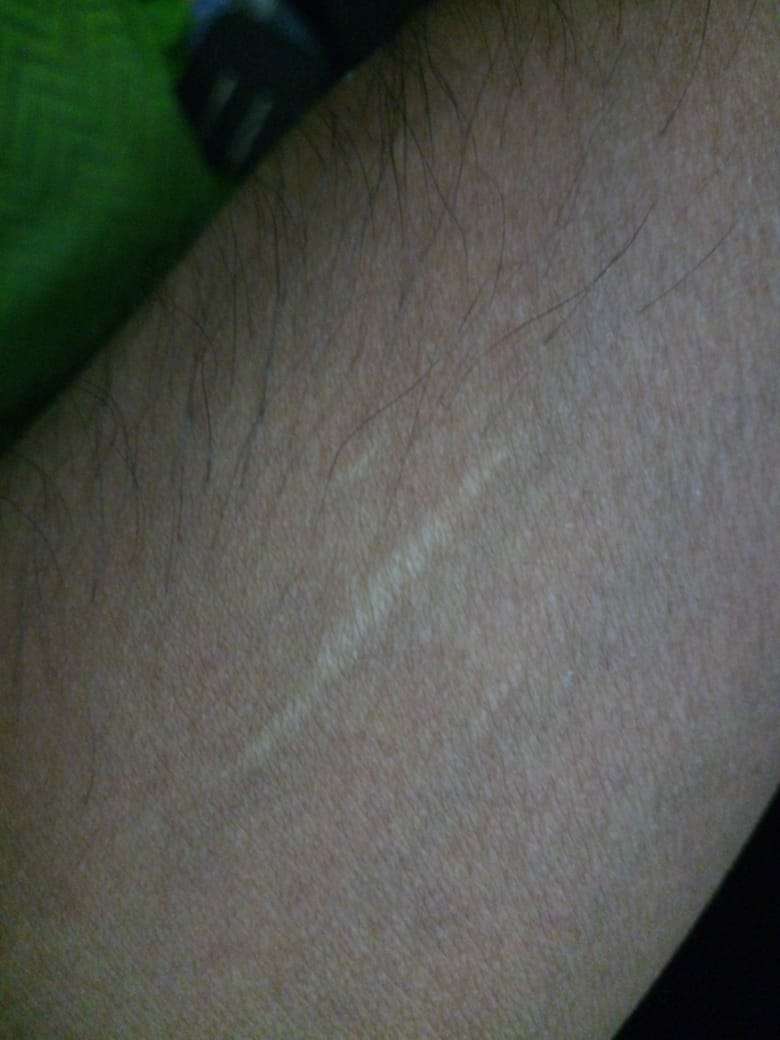 “Turmoq” deyishning harom usuli qanday?